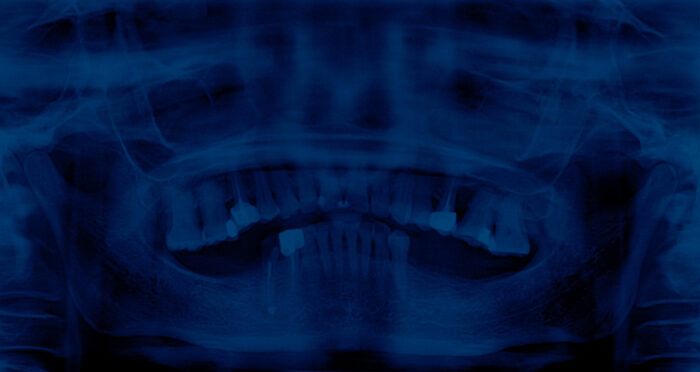 War 001